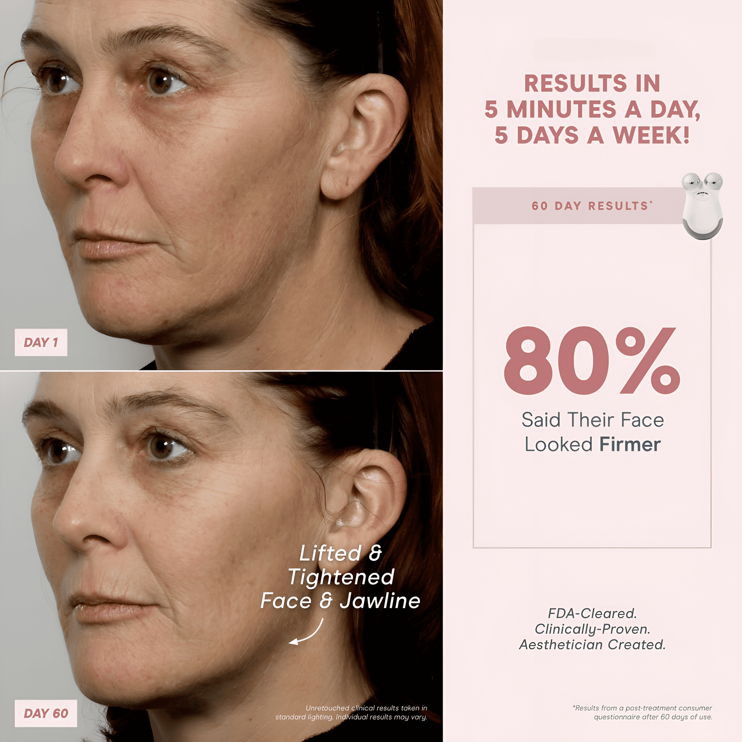 FaceLift Pro Espariat™